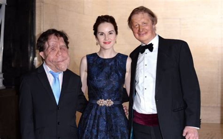Unveiling the Life of Adam Pearson's Wife: A Journey of Love and Support