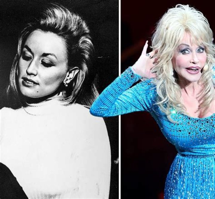 Dolly Parton: A Glimpse of Authenticity Without Her Wig