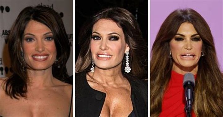 Revealing the Transformation: A Look at Kimberly Guilfoyle's Plastic Surgery Photos