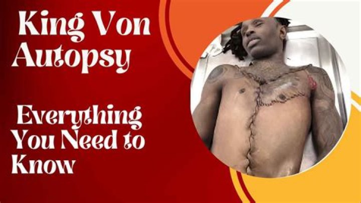 Unraveling the Mystery: King Von Autopsy Photos and Their Impact