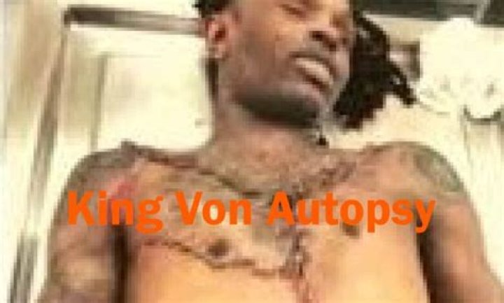 Unpacking the Mystery Behind King Von's Autopsy Picture