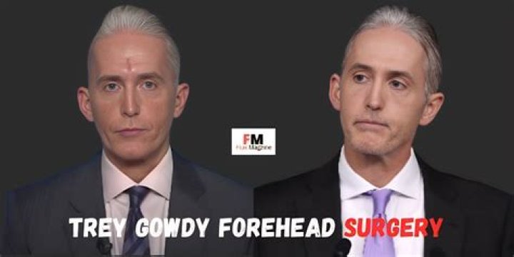 Trey Gowdy's Transformation: A Closer Look at His Face Surgery