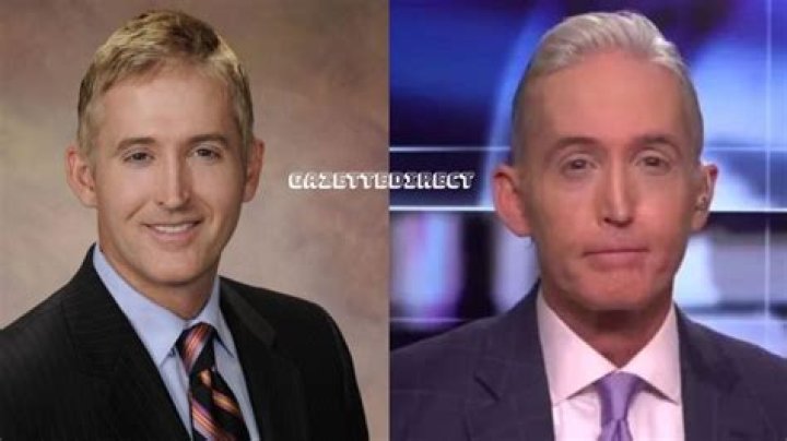 Trey Gowdy: A Look at His Nose Before and After